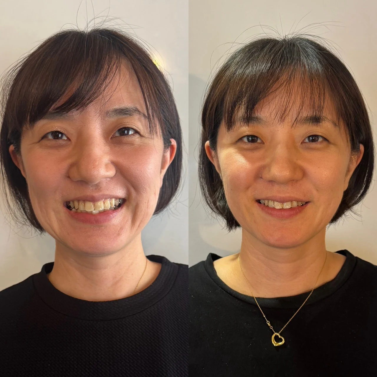 第1期受講生の正面。左が受講前、右が受講後。撮影時の表情は異なります