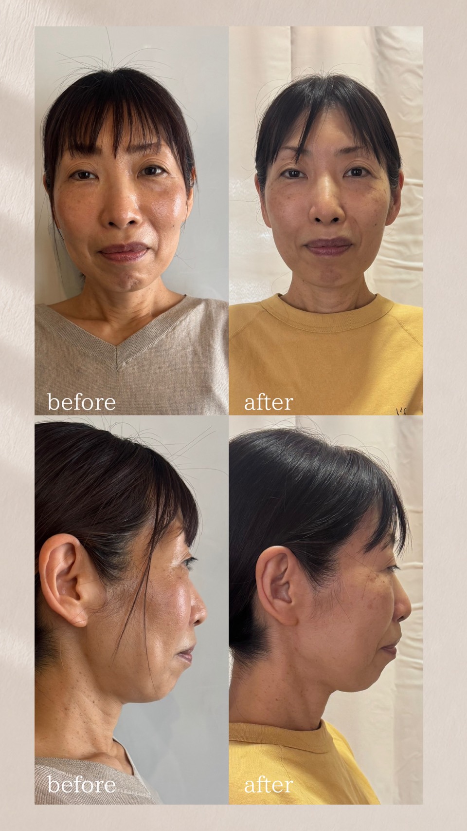 第1期受講生の受講前後の写真 正面と横顔